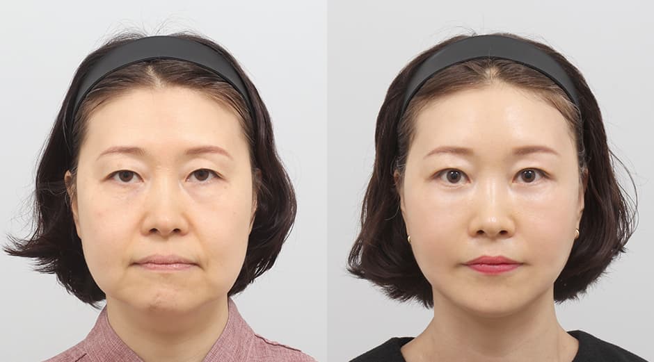 AB Plastic Surgery