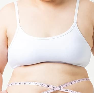 肥胖型巨大乳房症