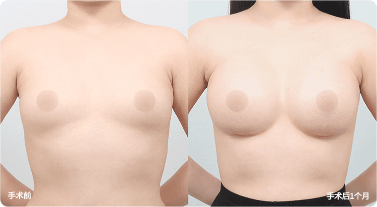 AB plastic surgery