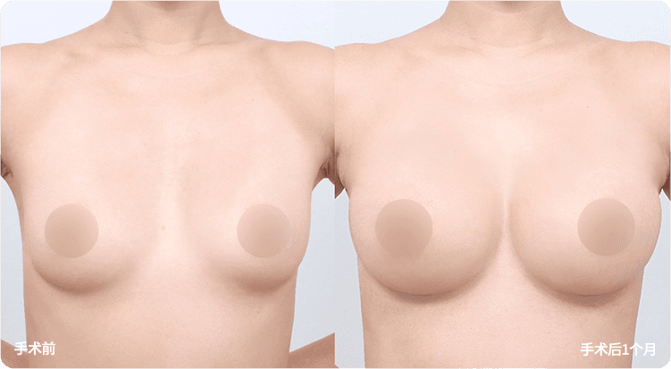 AB plastic surgery