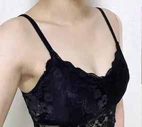 術前