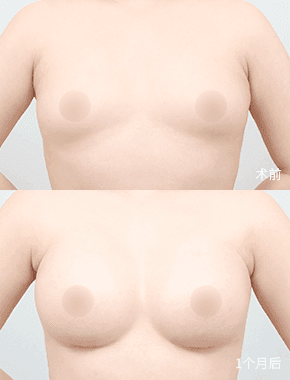 before-after