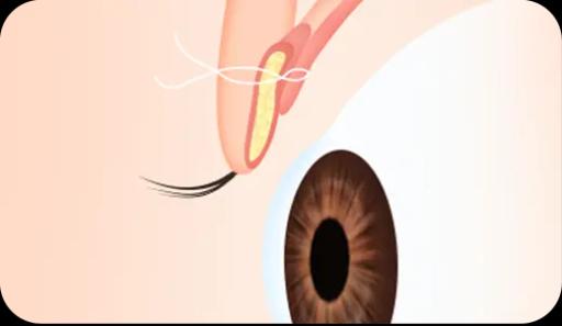 surgery_illust