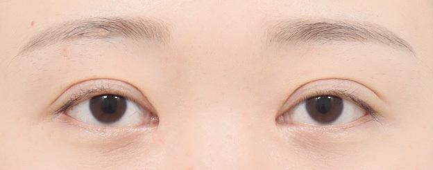 AB plastic surgery