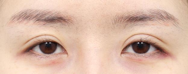AB plastic surgery