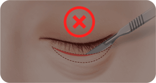 surgery_illust