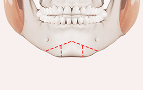 surgery_illust