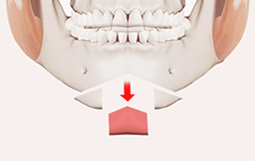 surgery_illust