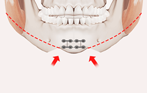 surgery_illust