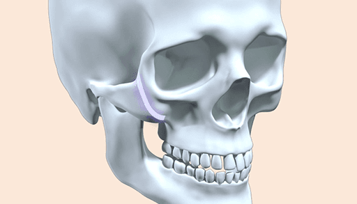 surgery_illust