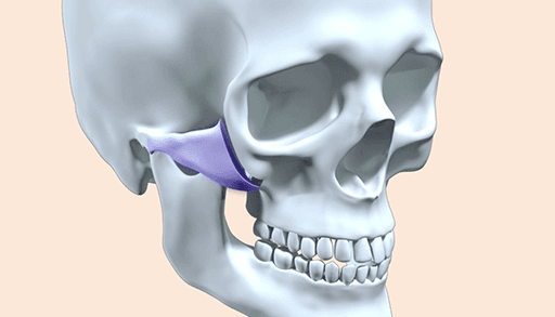 surgery_illust