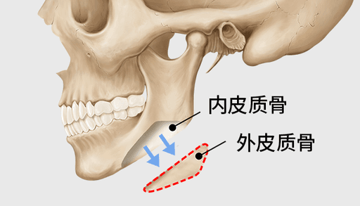 surgery_illust