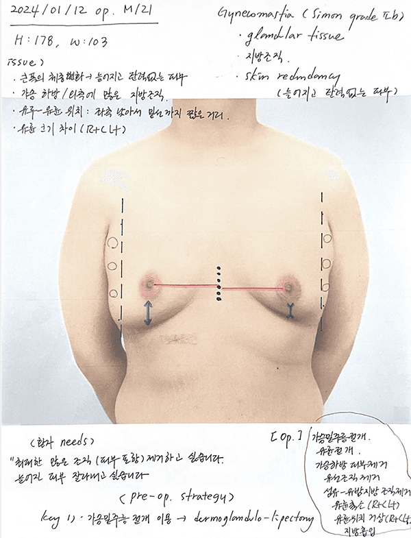 surgery memo