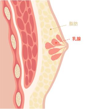 Gynecomastia surgery