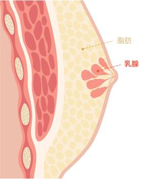 Gynecomastia surgery