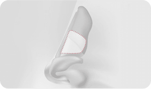 surgery_illust