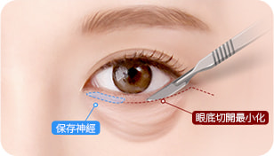 surgery_illust