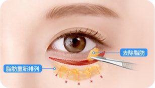 surgery_illust