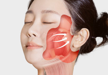 無神經損傷、準確、寬範圍剝離