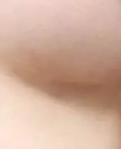 2个月后，胸下线部位