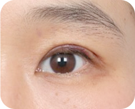 The Key to Beautiful Eyes