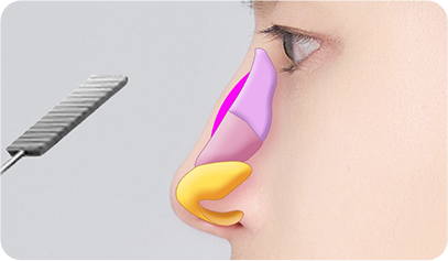 surgery_illust