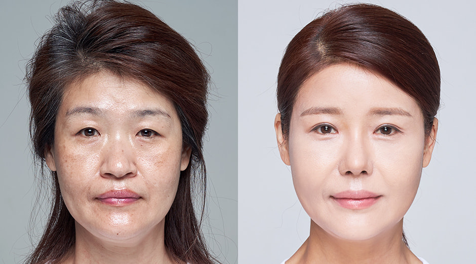 AB Plastic Surgery