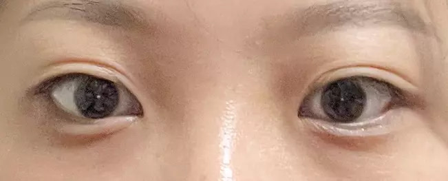 Long lasting before after case 5
