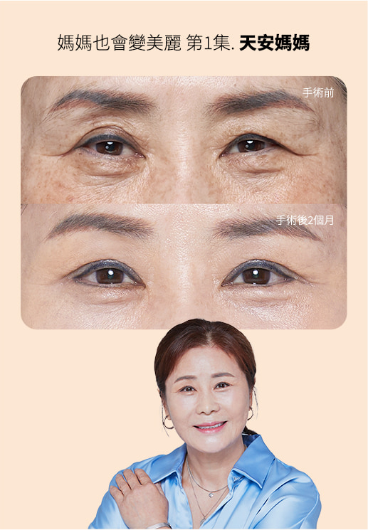 Beauty Moms 第1集變美案例