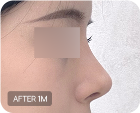 Before and after 1-2