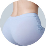 Liposuction result 6