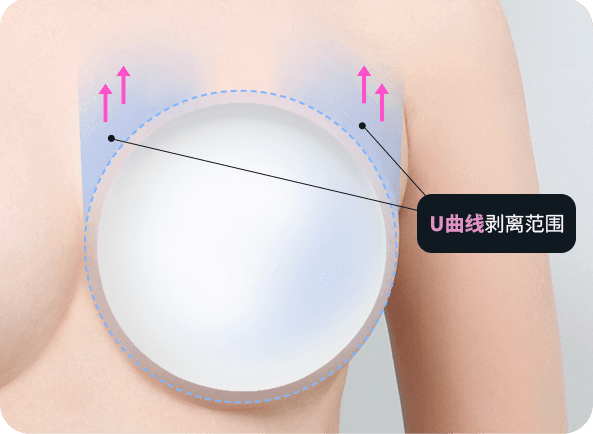 Ab Surgery