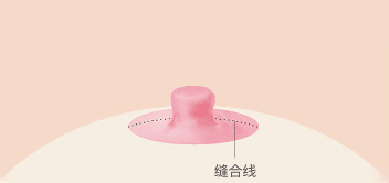 AB Plastic Surgery