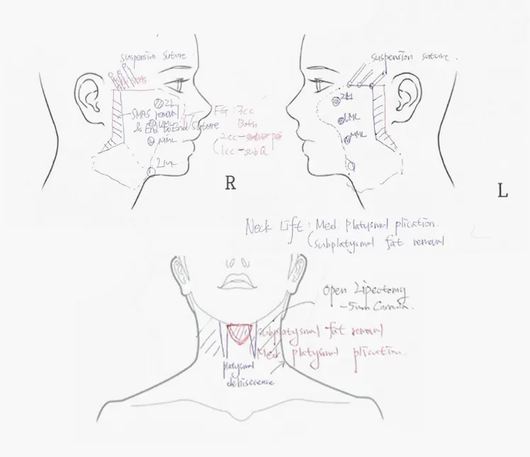 실제 상담 노트 작성본