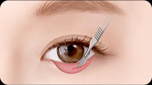 surgery_illust