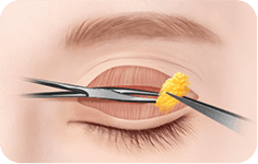 surgery_illust