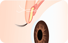 surgery_illust