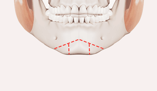 surgery_illust