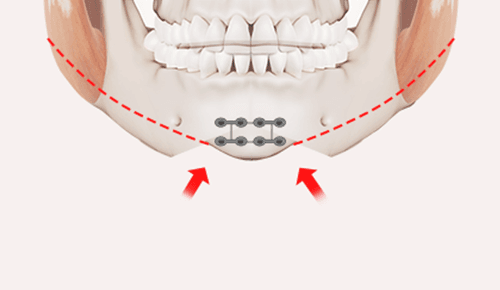 surgery_illust