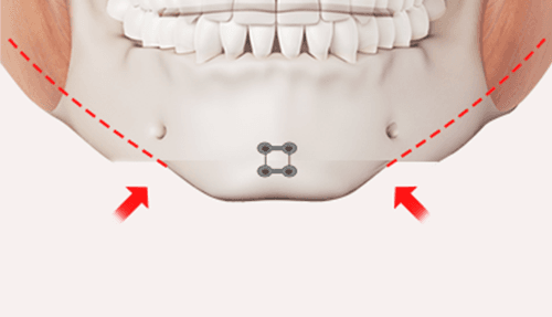 surgery_illust