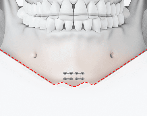 surgery_illust