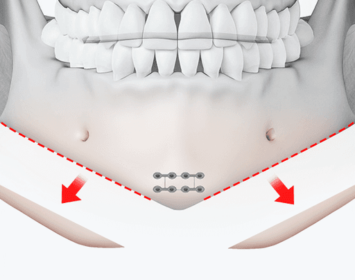 surgery_illust
