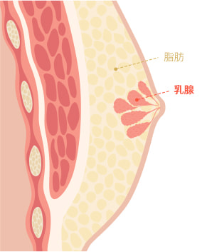 Gynecomastia surgery