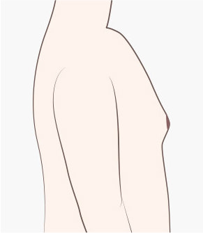 surgery_illust