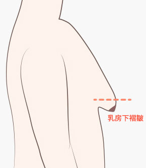 surgery_illust