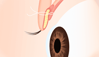 AB Plastic Surgery