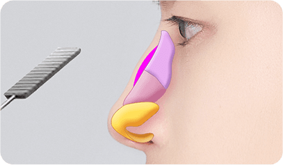 surgery_illust