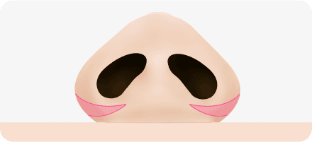 surgery_illust