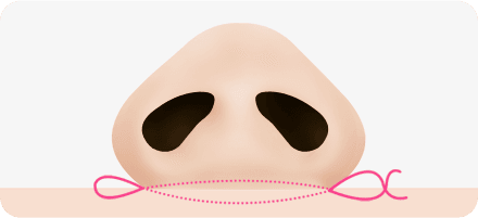 surgery_illust