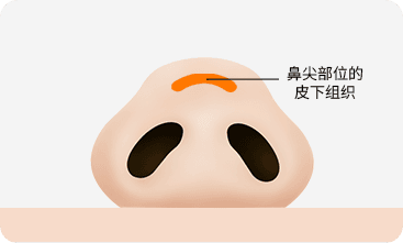 surgery_illust